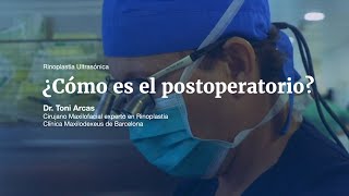 ¿Cómo es el postoperatorio de la Rinoplastia Ultrasónica [upl. by Bruns]