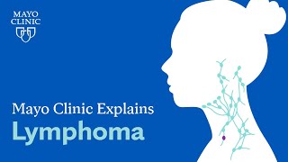 Mayo Clinic Explains Lymphoma [upl. by Nahsab]