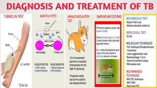 Diagnosis and treatment of Mycobacterium TB  Tuberculin mantoux test  Medical micro Part3 [upl. by Horatius]