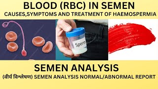 BLOOD IN THE SEMENRBC IN THE SEMEN ANALYSIS CAUSES AND TREATMENT OF BLOOD IN THE EJACULATE [upl. by Elephus84]