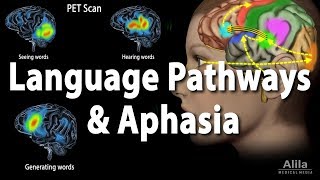 Language Pathways and Aphasia Animation [upl. by Anyela485]