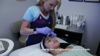 Platelet rich plasma PRP facial treatment [upl. by Yaned642]