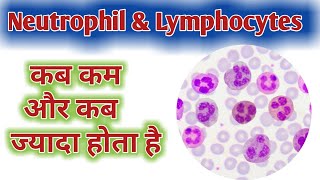 Neutrophil high Causes  Lymphocytes high Causes  Low Neutrophil  Low Lymphocytes [upl. by Aziaf718]