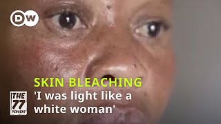 Skin bleaching The risks behind the beauty craze [upl. by Rambert638]