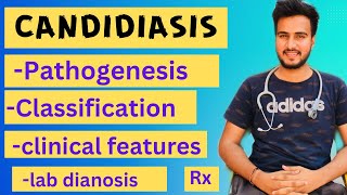 Candidiasis microbiologypathogenesislabdiagnosisTreatment [upl. by Bergwall]