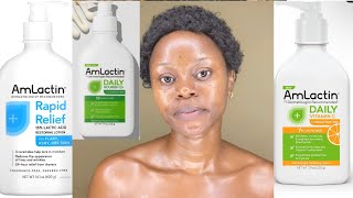 AMLACTIN LOTION REVIEW  HOW TO USE AMLACTIN LOTION FOR BEST RESULT  Amlactin lotion [upl. by Atineb]