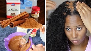 CINNAMON HAIR MASK  OVERNIGHT HAIR GROWTH [upl. by Roxi329]