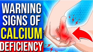 7 ALARMING Signs Of Calcium Deficiency Causes Of Calcium Deficiency [upl. by Anibla]