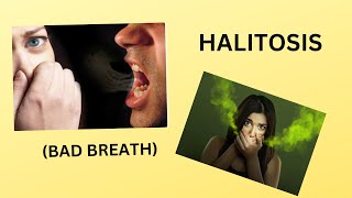 HALITOSIS BAD BREATHஅருவருக்கத்தக்க ஊத்தை நாற்றம் என் வருது [upl. by Ailenroc]