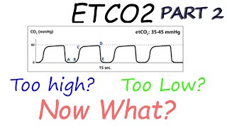 Capnography Waveform Interpretation Advanced  Why perfusion matters [upl. by Wahl862]