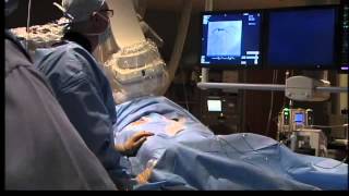 New catheterization procedure available in Lafayette [upl. by Cheston173]