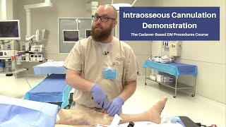 Intraosseous Cannulation Demonstration  The CadaverBased EM Procedures SelfStudy Course [upl. by Arabel106]