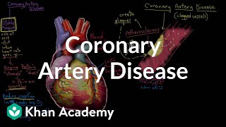 What is coronary artery disease  Circulatory System and Disease  NCLEXRN  Khan Academy [upl. by Anrat]