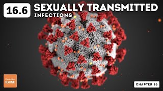 IGCSE Biology  Sexually transmitted infections 166 [upl. by Rats]