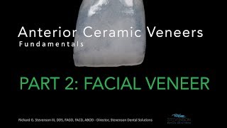 Anterior Ceramic Veneers Part 2 Facial Veneer [upl. by Monjo881]