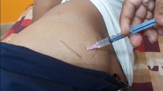 IM इंजेक्शन देने का सही तरीका  Easy steps to give Intramuscular injection  IM injection technique [upl. by Auqinal855]