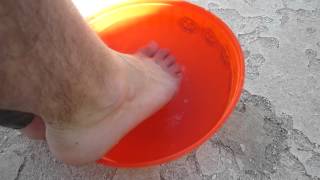 Best Athletes Foot Cure Chlorine Shock Treatment [upl. by Balthasar]