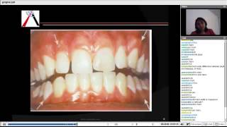 Periodontics  Gingiva and Tooth Supporting Structure [upl. by Hanaj]