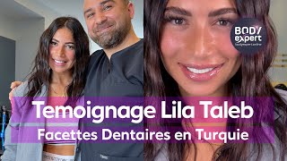 SOINS DENTAIRES  🦷 Témoignage de Lila Taleb  20 facettes dentaires Emax  BODYEXPERT [upl. by Bronny]