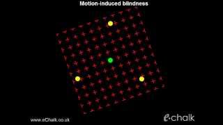 Motioninduced blindness test for the severity of ADHD  eChalk illusion [upl. by Sivrep600]