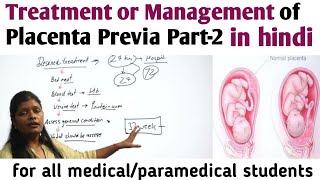 Management or treatment of Placenta Previa Part2  प्लेसेंटा प्रेविया में डिलीवरी नार्मल या ऑपरेशन [upl. by Enomrej]