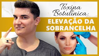 Botox®  Toxina Botulínica Elevação da Sobrancelha botox [upl. by Lehcir916]