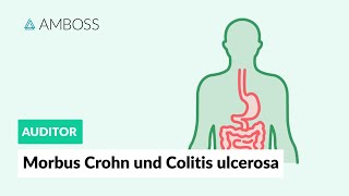 Morbus Crohn und Colitis ulcerosa  Worin unterscheiden sie sich  AMBOSS Auditor [upl. by Leila]