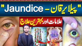 Jaundice Symptoms and Treatment  Jaundice Foods To Eat and Avoid  Pela Yarkan Ka ilaj [upl. by Thant332]