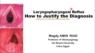 Laryngopharyngeal Reflux How to Justify the Diagnosis [upl. by Kamaria]