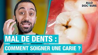 🦷 Comment soigner une CARIE  Les réponses du Dr Jimmy Mohamed [upl. by Enyale]