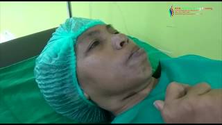 Nyeri di Wajah karena Trigeminal Neuralgia Sembuh dengan Radiofrekuensi [upl. by Ettezel]