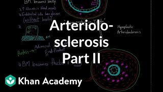 Arteriolosclerosis  part 2  Circulatory system diseases  Health amp Medicine  Khan Academy [upl. by Peadar]