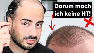 Reue nach der Haartransplantation  Er hat einen Fehler gemacht [upl. by Keese]