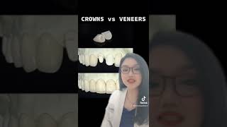 VENEERS vs CROWNS  Dr Bianca Beley  Short 2 [upl. by Sydney]