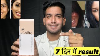 7 दिन में result  Golite cream  Golite cream review  Golite cream kaise use kare  Golite use [upl. by Yeldah817]