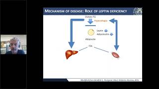 Understanding Lipodystrophy [upl. by Rici]