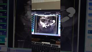 X ray  fluoroscopy procedure  fluoroscopy trending viral shorts arabic [upl. by Ritchie]