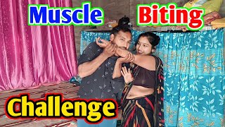 Muscle Biting challenge ll biting challenge husband wife ll funny biting challenge [upl. by Anauqes]