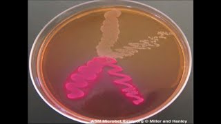 Micro Lab 6 Selective and Differential Media [upl. by Coffee]