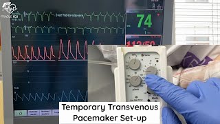 Temporary transvenous pacemeker setup [upl. by Shank52]