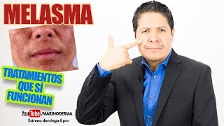 PAÑO MELASMA TRATAMIENTOS QUE SÍ FUNCIONAN DR MARINO DERMATÓLOGO [upl. by Ahtamas]