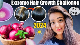 7 Days Super Fast Hair Growth Challenge  Before amp After  Grow The Longest Hair In Summer  RuntiMe [upl. by Jaynes]