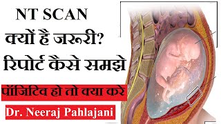 NT Scan in Hindi  प्रेगनेंसी के 13 हफ्ते का सबसे जरूरी टेस्ट NT Test [upl. by Aikemaj]