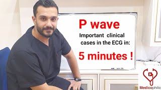 As simple as this  Mastering P wave clinical cases in the ECG in 5 minutes [upl. by Selway943]