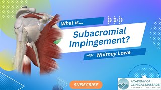 What is Subacromial Impingement [upl. by Ailaro]