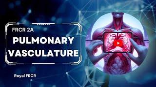 16  Chest Imaging for FRCR [upl. by Findley]