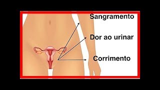 Symptome von Chlamydien bei Männern und Frauen [upl. by Stefan729]