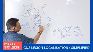 CNS Lesion Localisation at your Finger Tips by Dr Gireesh Kumar KP  Simplified Version [upl. by Murray]