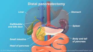 Pancreatic Surgery Benefits Risks and Relevant Anatomy [upl. by Busby]