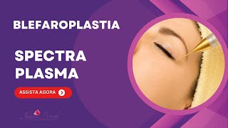 BLAFAROPLASTIA SEM CORTE COM SPECTRA PLASMA  JATO DE PLASMA [upl. by Aia440]